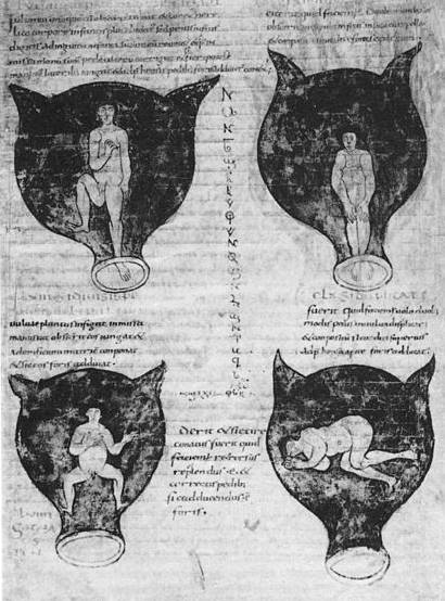 Book of Gynecology by Soranus the Physician from Ephesus